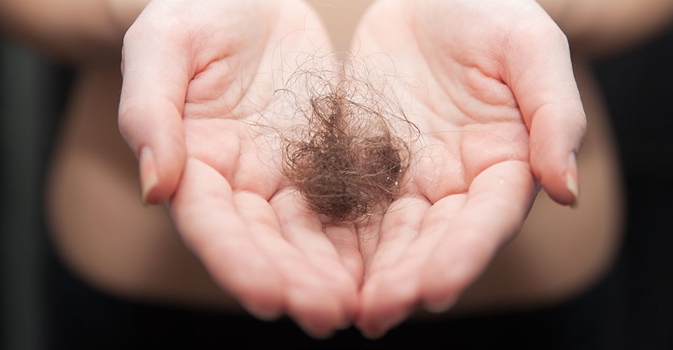 چگونه جلوی ریزش شدید موی سر را بگیریم؟ (بهترین روشهای طبیعی کاهش ریزش مو)